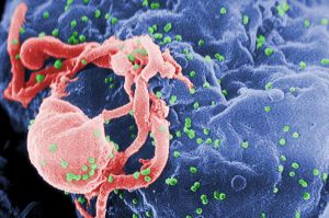 Pourrait-on lutter contre le Sida avec l’ADN humain?