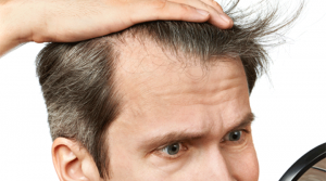 Quels aliments privilégier pour venir à bout de la perte des cheveux ?